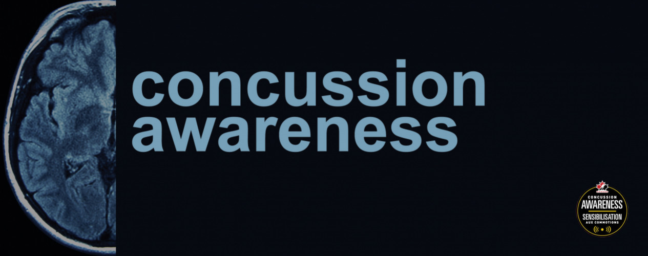 Concussions